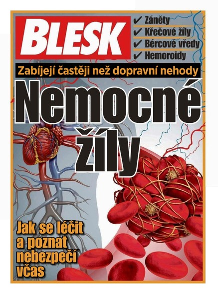 Příloha Blesku - 19.9.2016