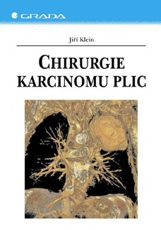 Chirurgie karcinomu plic