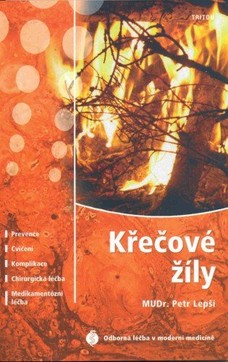 Křečové žíly