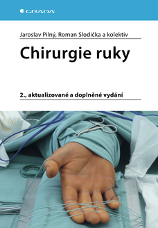 Chirurgie ruky