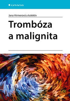 Trombóza a malignita