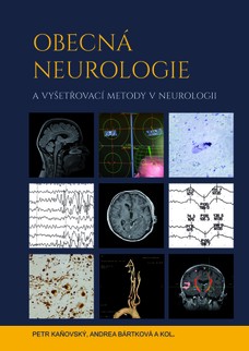 Obecná neurologie a vyšetřovací metody v neurologii