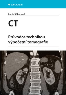 CT - Průvodce technikou výpočetní tomografie