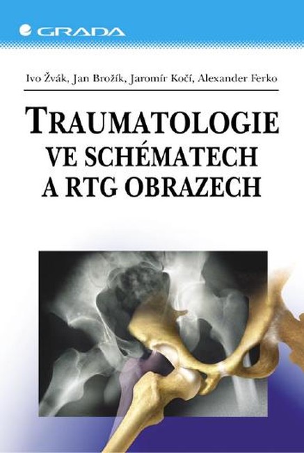 Traumatologie ve schématech a RTG obrazech