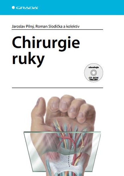 Chirurgie ruky