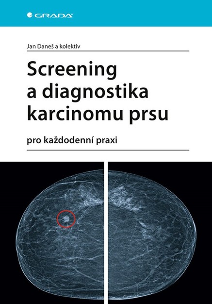 Screening a diagnostika karcinomu prsu