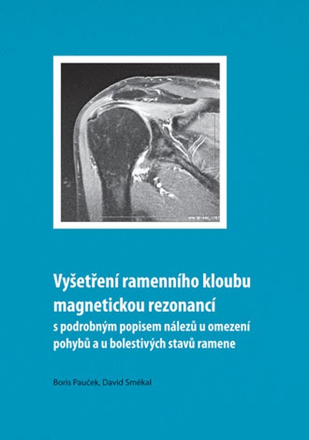 Vyšetření ramenního kloubu magnetickou rezonancí s podrobným popisem nálezů u omezení pohybů u bolestivých stavů ramene