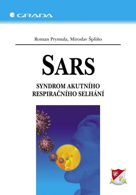 SARS